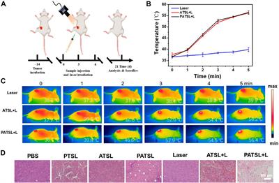 Light-activatable and hyperthermia-sensitive “all-in-one” theranostics: NIR-II fluorescence imaging and chemo-photothermal therapy of subcutaneous glioblastoma by temperature-sensitive liposome-containing AIEgens and paclitaxel